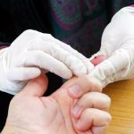 Paraná completa 7 anos sem transmissão local de malária